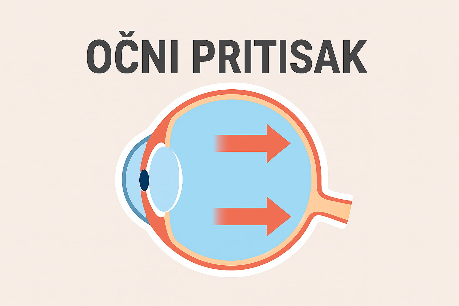 Šta je zapravo očni pritisak?