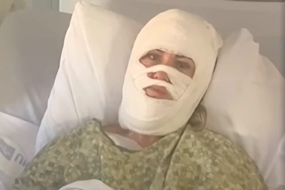 Žena šetala parkom, a onda ju je nepoznati muškarac polio kiselinom Ubrzo je počela gorjeti